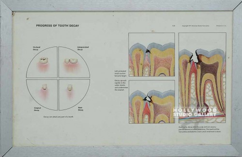 13x19 Tooth Decay Slvr Mtl Frm