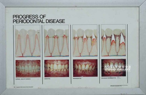 13x19 Periodontal Disease Slvr Mtl